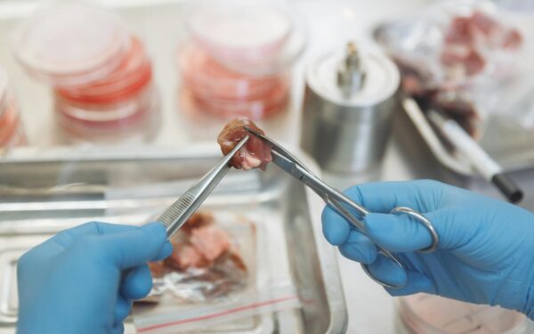 How 3D-printed organs are moving from science fiction to the lab bench