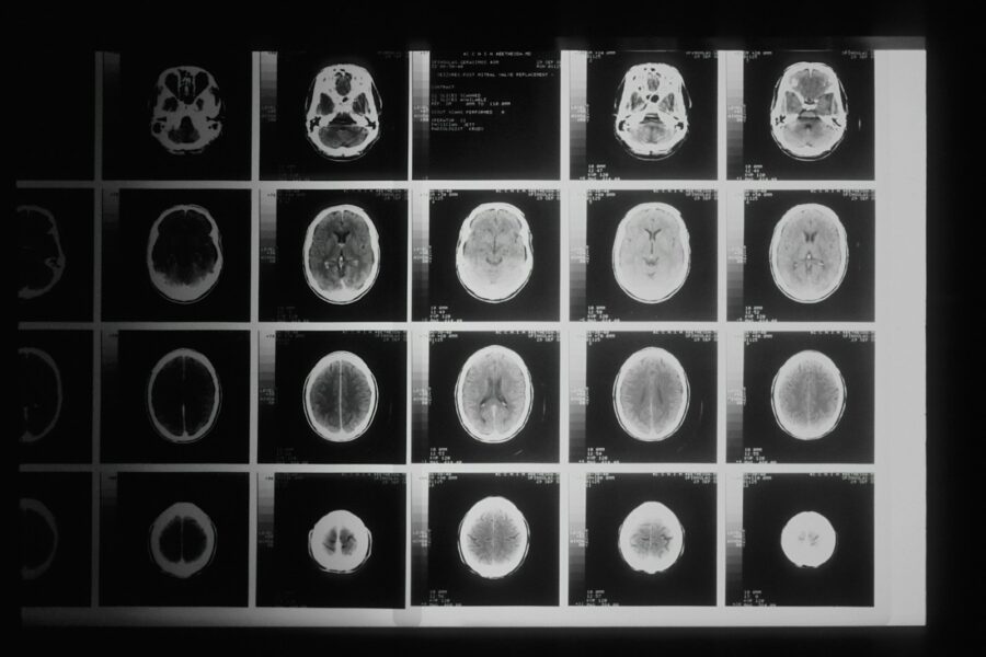 Brain computer interface