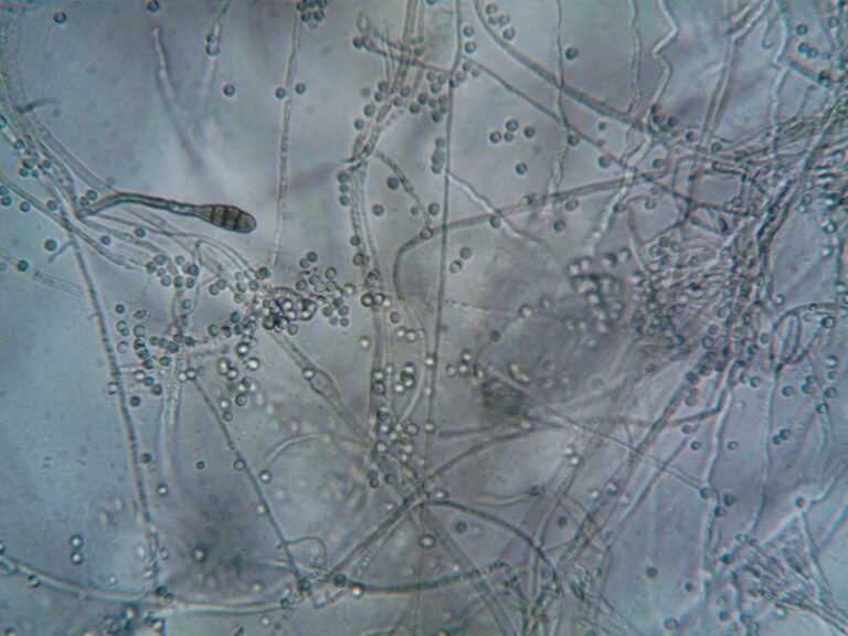 Microscopic fungi hyphae