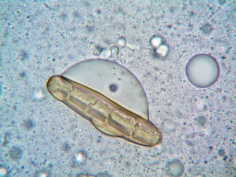 Intestine organoids microscope