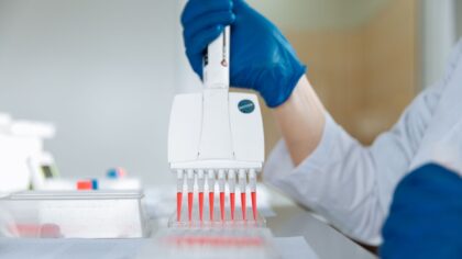 How lab-on-a-chip devices are shrinking science to the size of a credit card