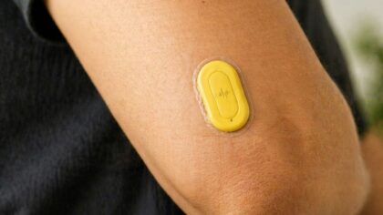 How wearable ultrasound patches are turning blood flow into a vital sign