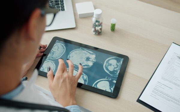 How brain-computer interfaces are quietly moving from lab experiments to medical tools