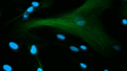 How fluorescence microscopes reveal hidden worlds in living cells