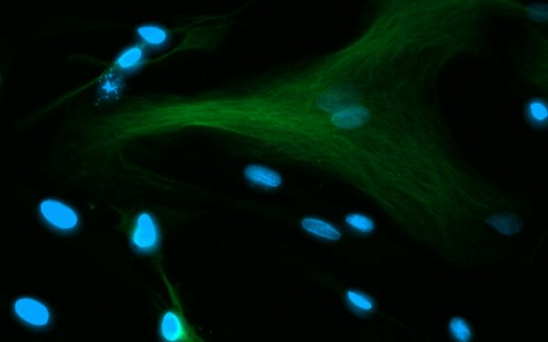 How fluorescence microscopes reveal hidden worlds in living cells