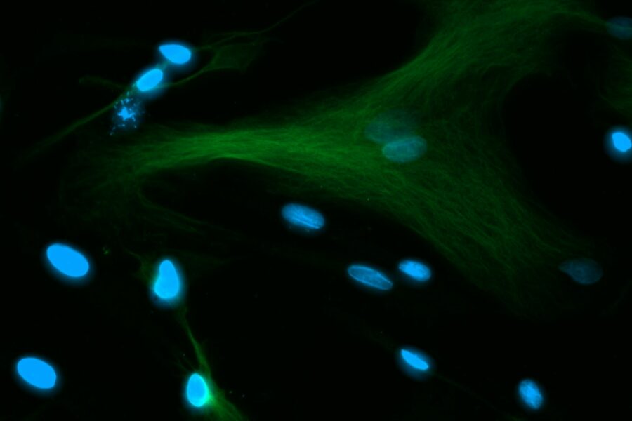 Fluorescence microscope glowing