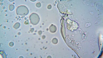 How lab-grown mini organs are changing research and pointing to future therapies