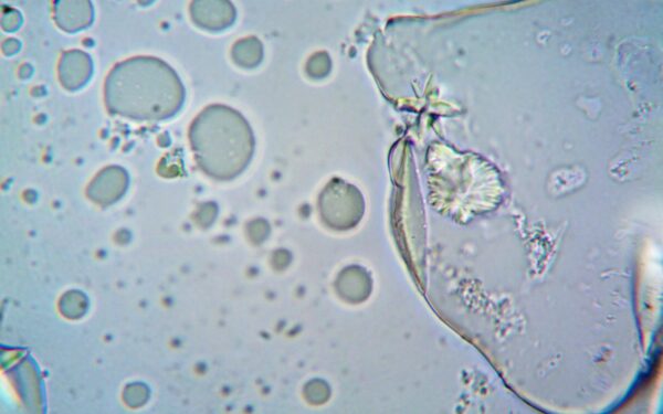 How lab-grown mini organs are changing research and pointing to future therapies